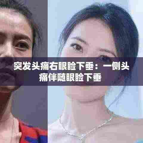 突发头痛右眼睑下垂:一侧头痛伴随眼睑下垂
