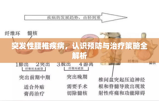 突发性腰椎疾病，认识预防与治疗策略全解析