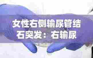 女性右侧输尿管结石突发:右输尿管结石是怎么引起的