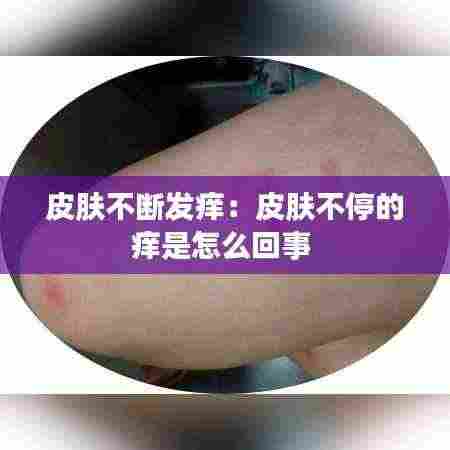 皮肤不断发痒:皮肤不停的痒是怎么回事
