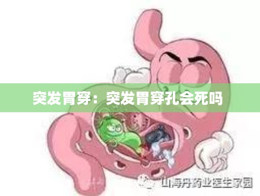 突发胃穿:突发胃穿孔会死吗