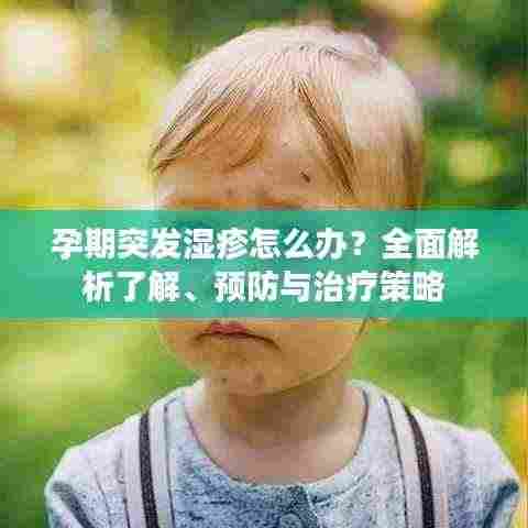 孕期突发湿疹怎么办?全面解析了解、预防与治疗策略